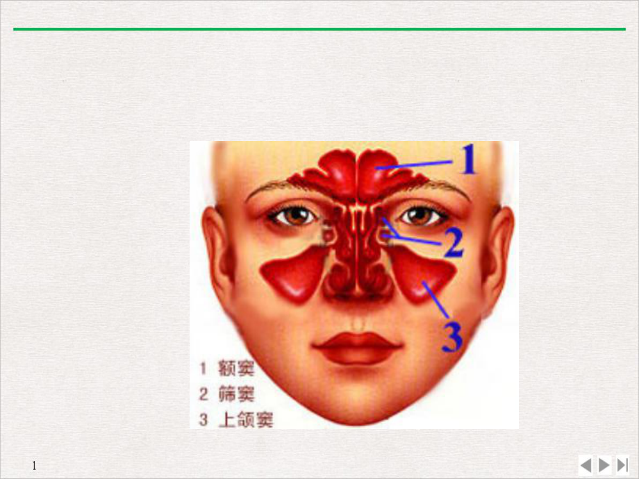 鼻腔及鼻窦异物鼻窦炎性疾病教学课件.ppt_第3页