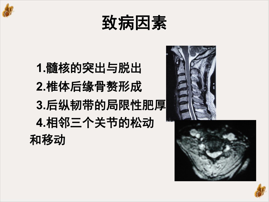 神经根型颈椎病与上肢周围神经课件.pptx_第3页