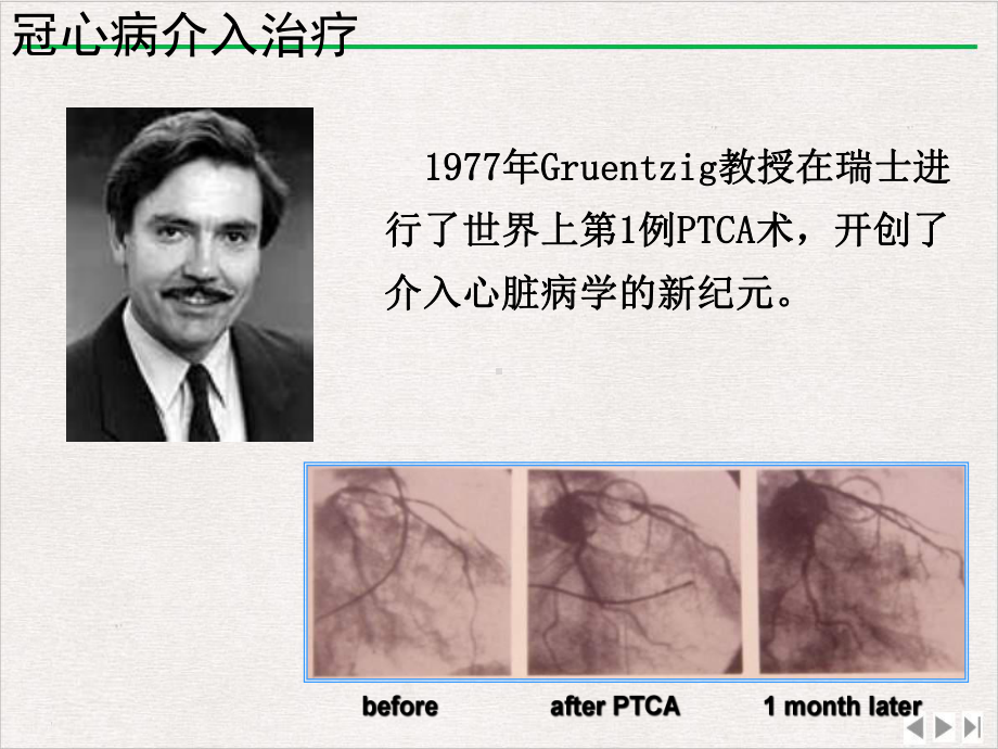 麝香保心丸对PCI患者心血管危险因素综合管理的价值版课件.pptx_第3页