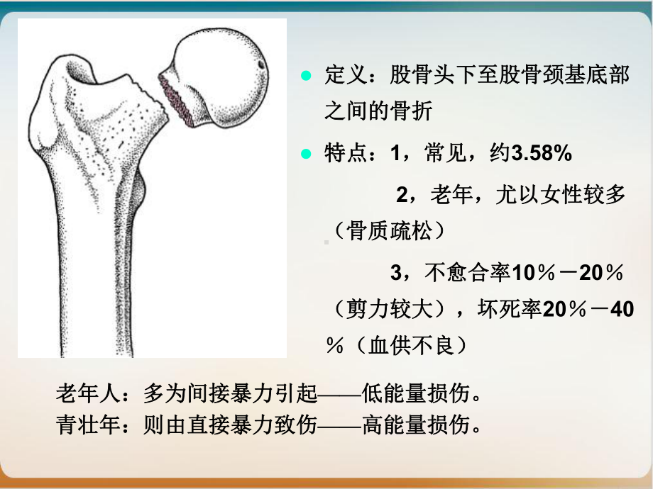 股骨颈骨折治疗选择课件1.ppt_第2页