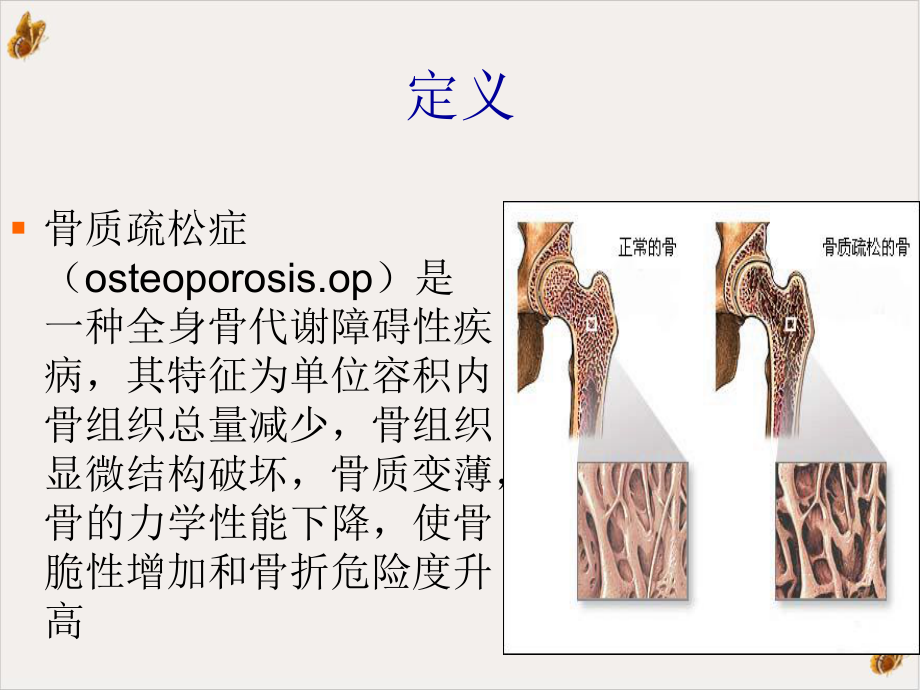 骨质疏松症的运动疗法教材课件.pptx_第3页