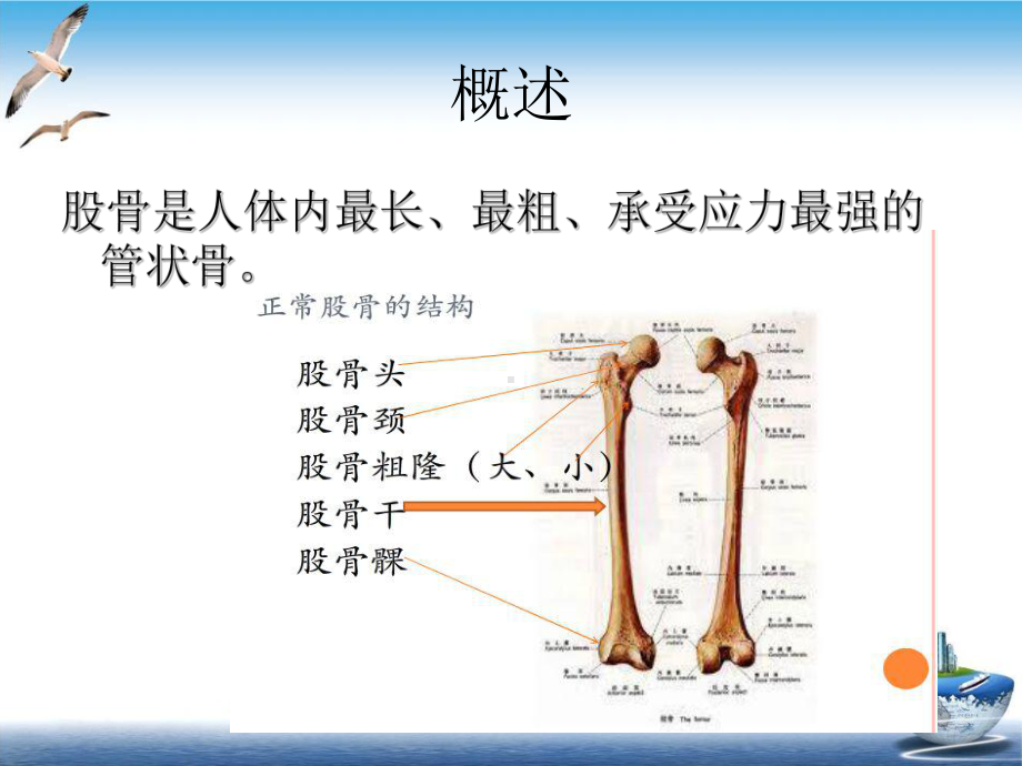 股骨骨折的健康宣教培训课程课件.ppt_第2页