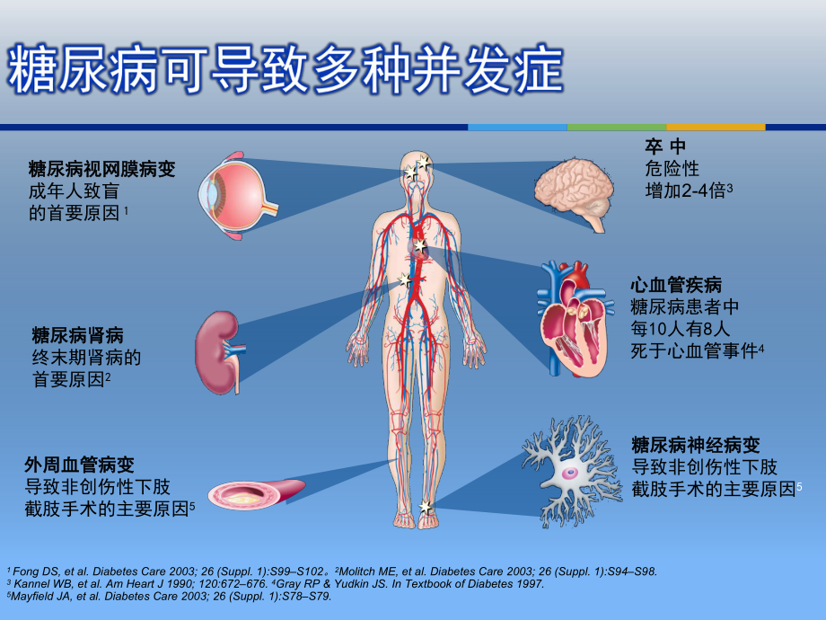 糖尿病肾病规范化诊疗课件.pptx_第2页