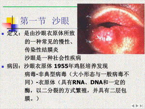 滤泡角膜血管翳课件.pptx