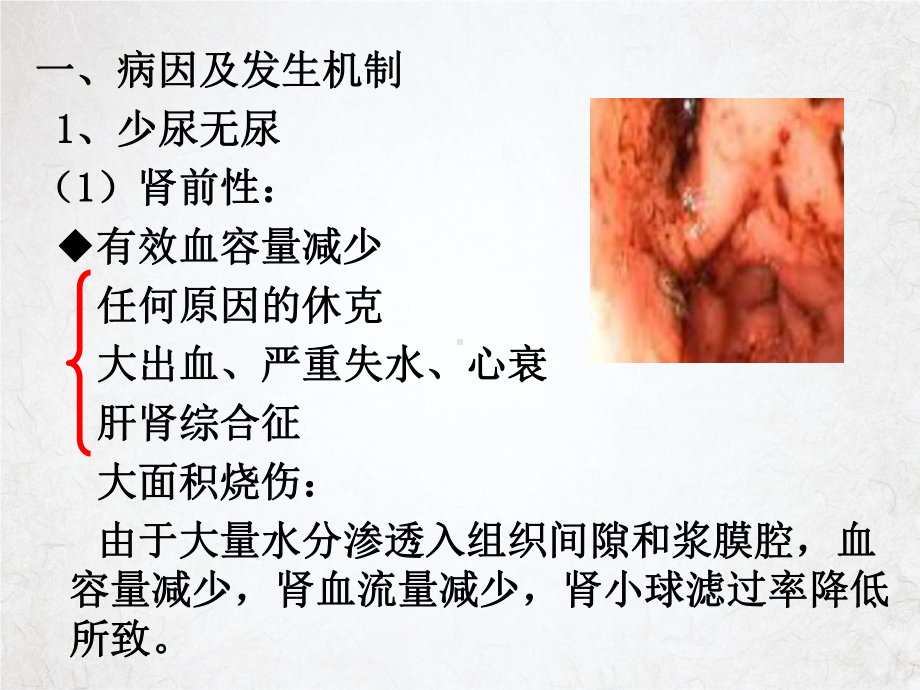 诊断学少尿无尿多尿侯欣课件.ppt_第2页