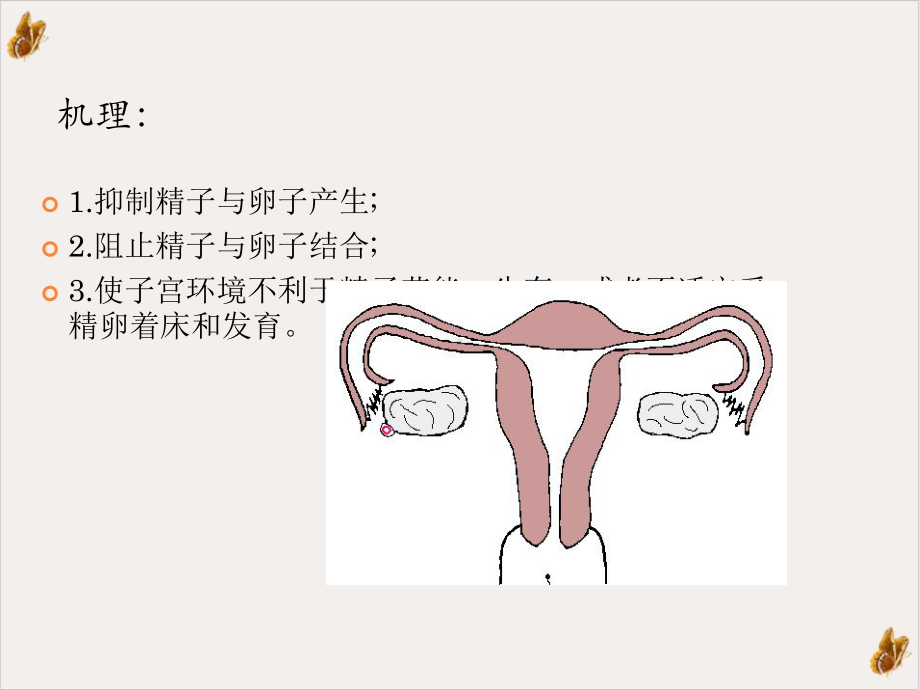 避孕药以外的避孕方式教学课件(同名195)课件.ppt_第2页