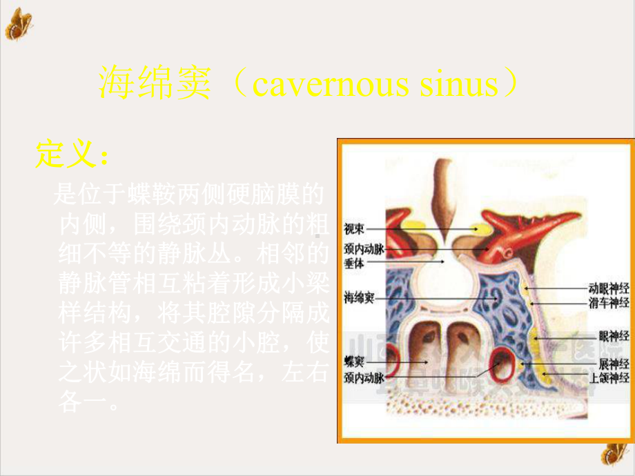 颈动脉海绵窦瘘课件.pptx_第1页