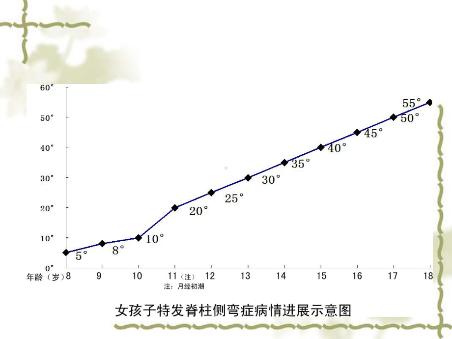 青少年特发性脊柱侧凸症临床诊断课件.ppt_第2页