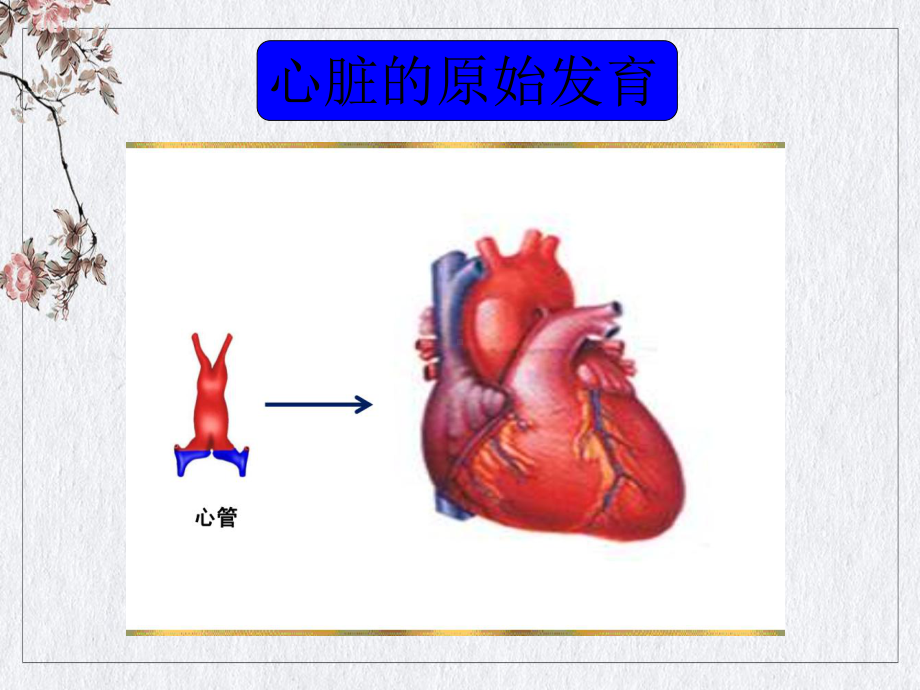 胎儿心脏锥干畸形有动画课件整理.ppt_第3页