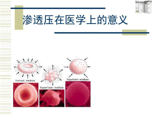 渗透压在医学上的意义课件.ppt