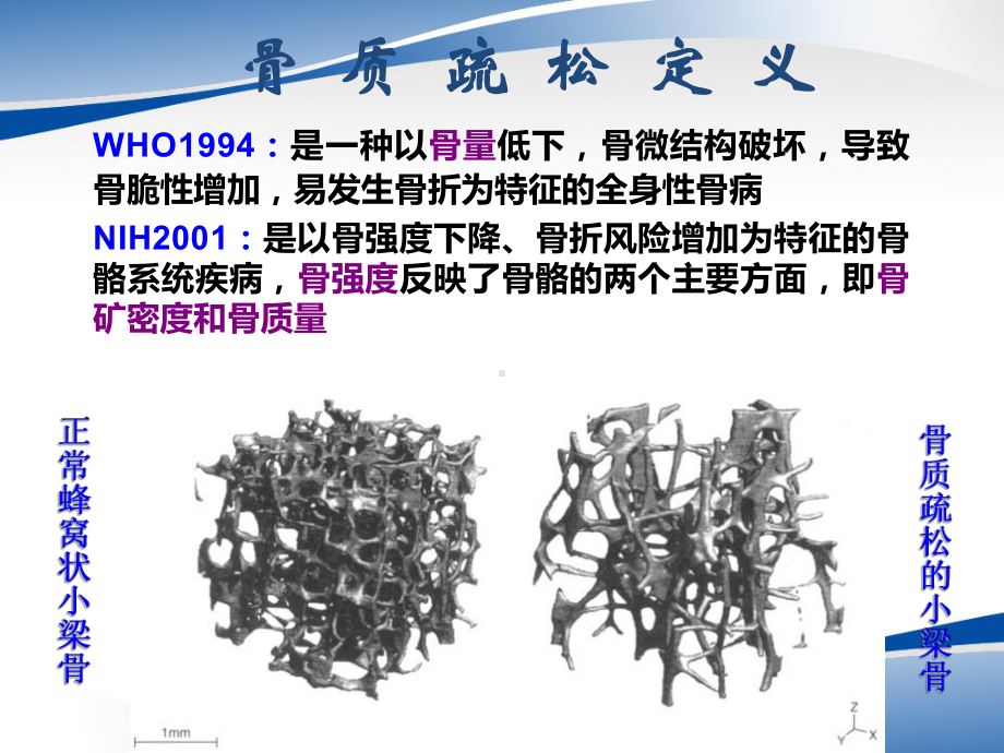 骨质疏松症的中西医结合治疗课件.ppt_第2页