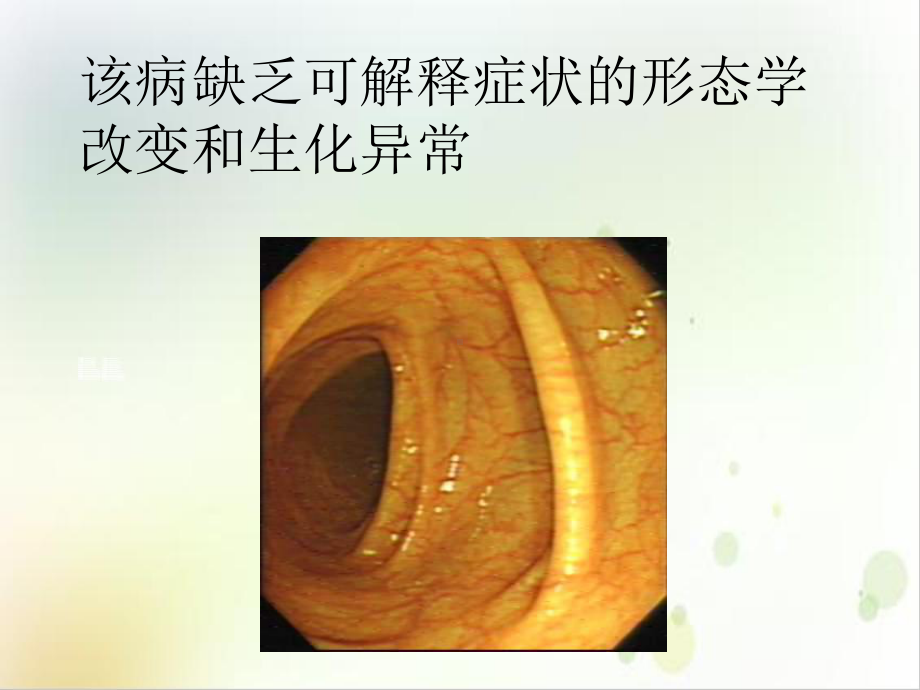 肠易激综合征课件讲义.ppt_第3页