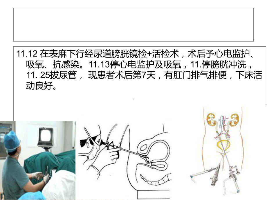 输尿管癌的护理查房讲课课件.ppt_第3页