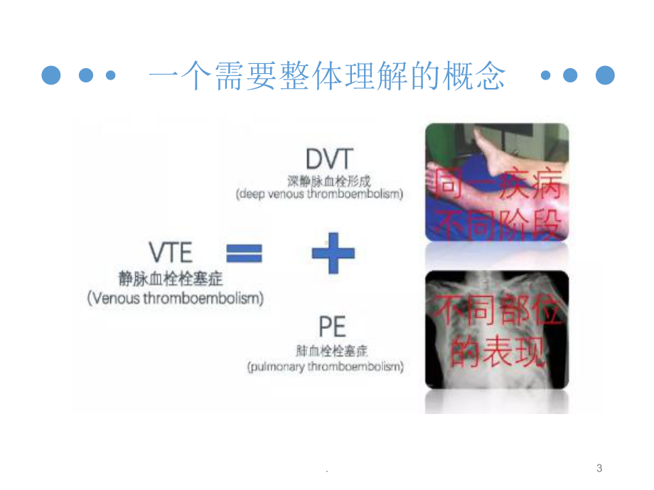 血栓的预防与管理课件.pptx_第3页