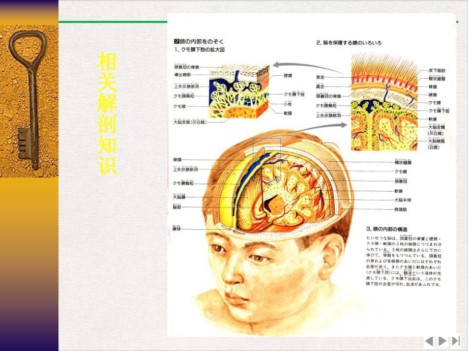 颅脑损伤手术治疗课件.pptx_第3页