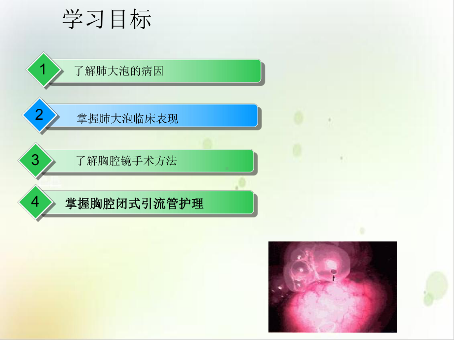 肺大泡病人的护理查房胸腔闭式引流的护理课件.ppt_第3页