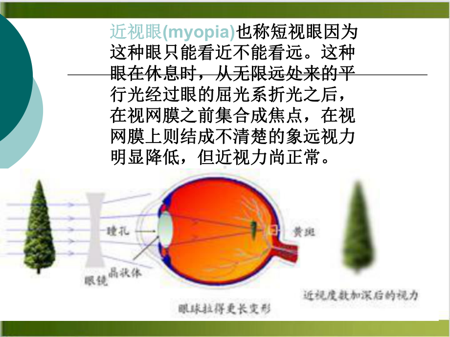 近视眼的形成与预防课件(模板).pptx_第3页