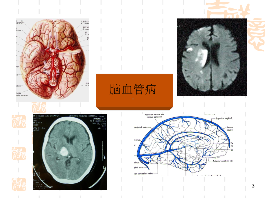 神经系统疾病讲课课件.ppt_第3页