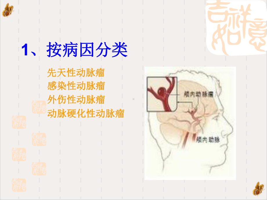 颅内动脉瘤夹闭术课件1.pptx_第2页