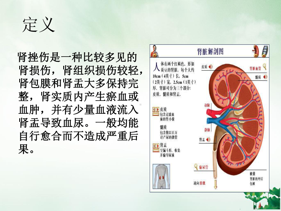 肾挫伤病人的护理查房讲课课件.ppt_第2页