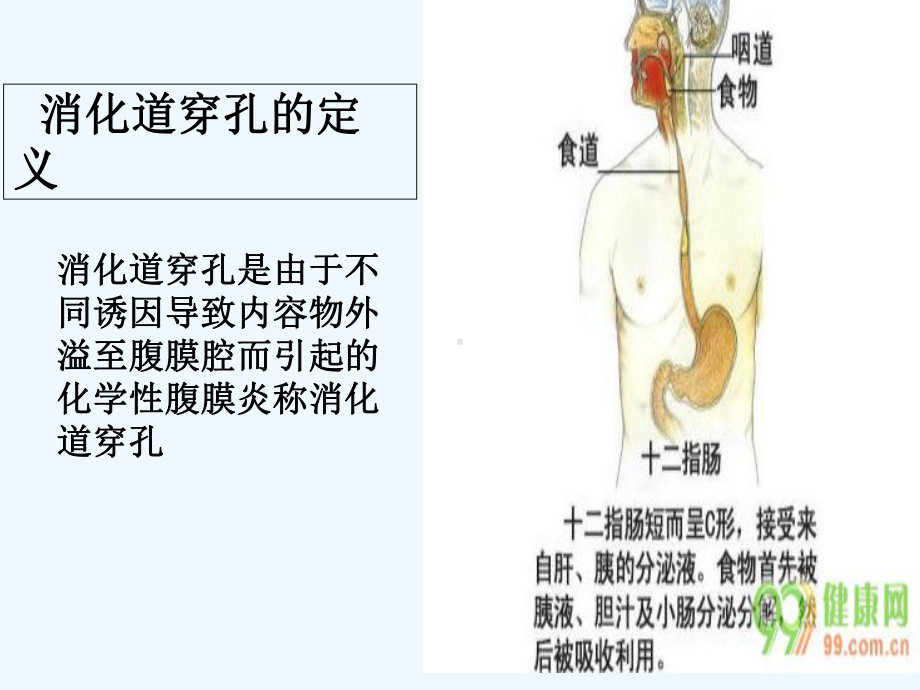 消化道穿孔护理查房-课件.ppt_第3页