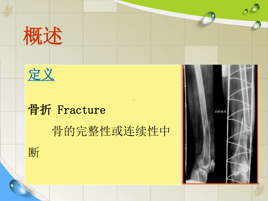 骨科常见病护理常规与功能锻炼教材课件.pptx_第2页