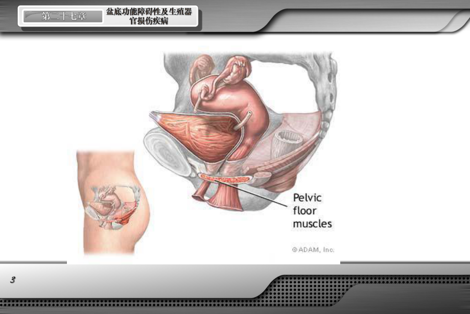 盆腔脏器脱垂课件.pptx_第3页