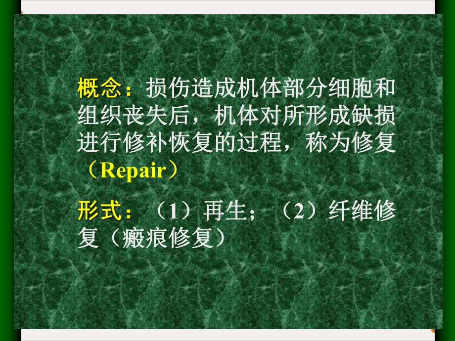 第二章损伤的修复(Repair)课件.ppt_第2页