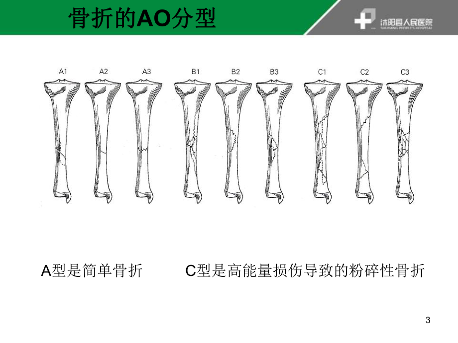 胫骨干骨折课件.ppt_第3页