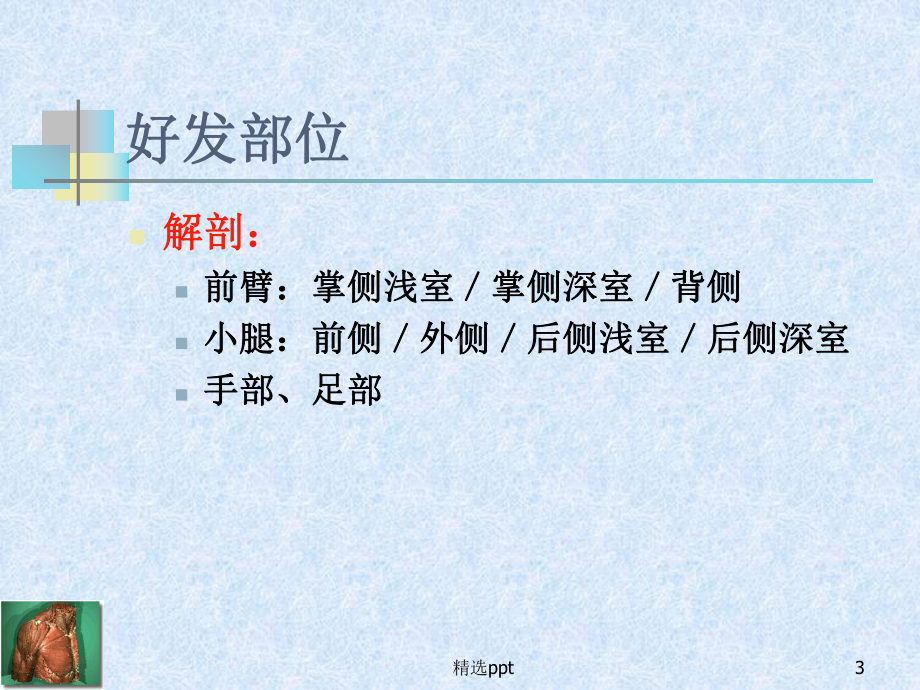 骨筋膜室综合征(同名1034)课件.ppt_第3页