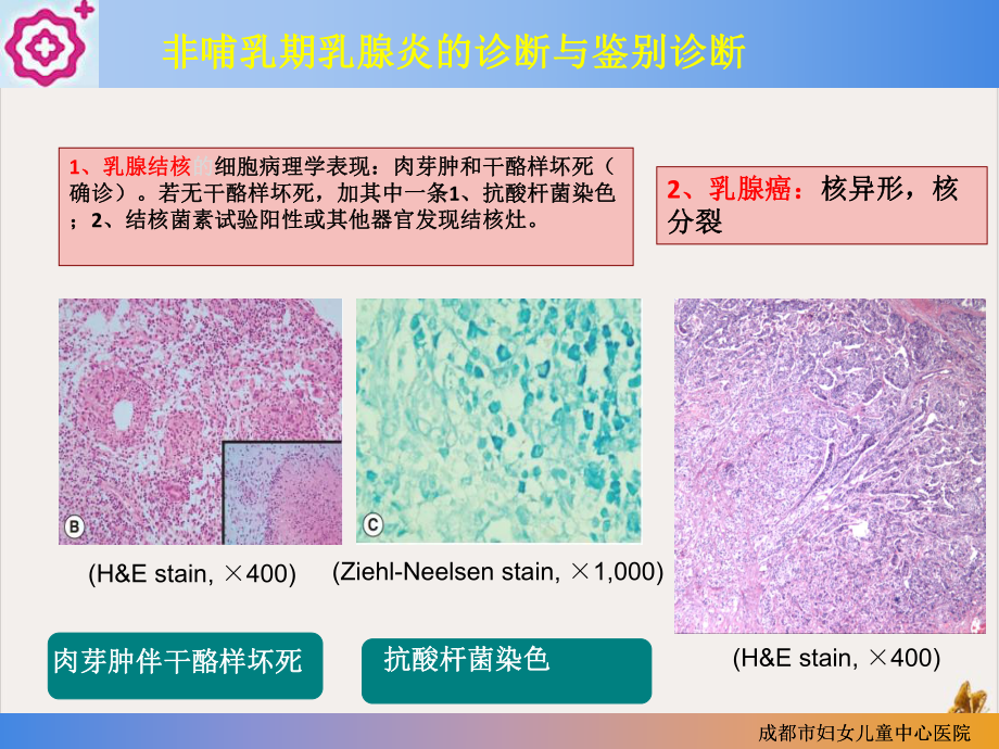 非哺乳期乳腺炎课件.pptx_第2页