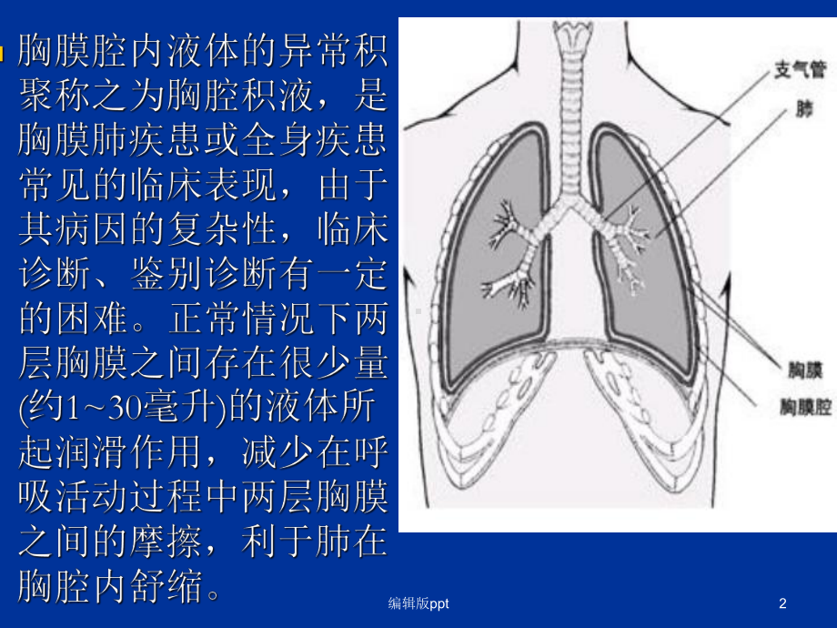 胸腔积液诊断进展课件.ppt_第2页