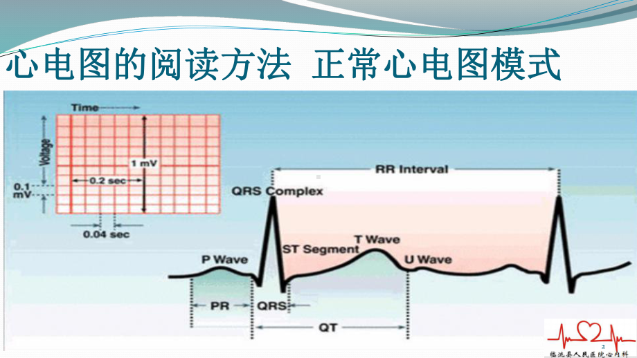 胸痛中心非核心科室ACS心电图培训课件.ppt_第2页