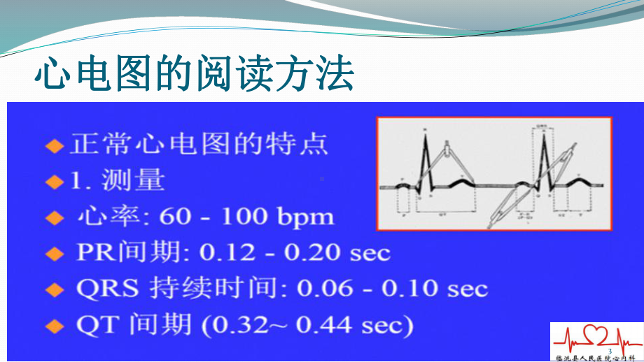 胸痛中心非核心科室ACS心电图培训课件.ppt_第3页