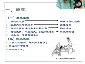 鼻饲并发症的预防与处理教学课件.pptx