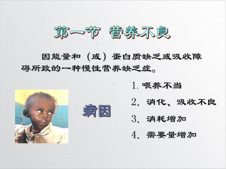 营养性疾病患儿的护理示范课件.ppt_第3页