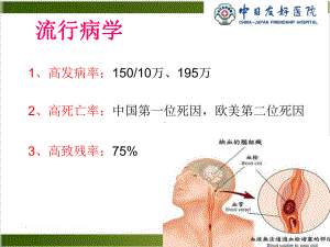 静脉溶栓的护理课件.pptx