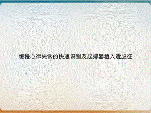 缓慢心律失常的快速识别及起搏器植入适应征课件.ppt