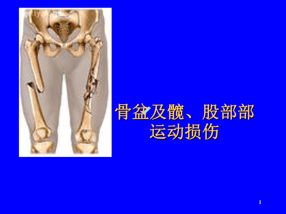 骨盆股部运动损伤课件.ppt_第1页