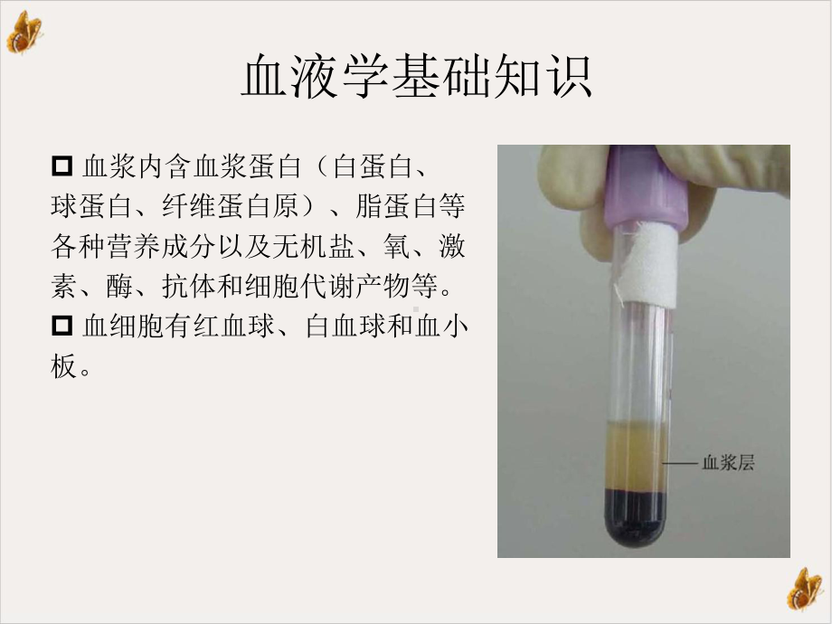 白血病基础知识培训课件.pptx_第2页