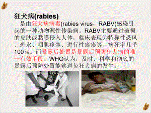 狂犬病暴露后急诊处置课件.pptx