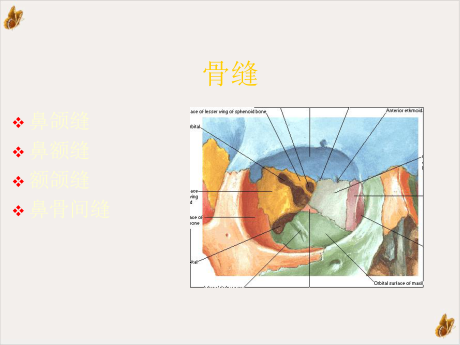 鼻骨骨折影像学诊断课件.pptx_第3页