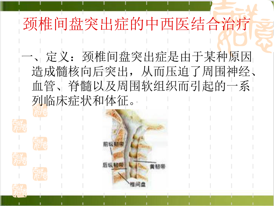 颈椎间盘突出症的中西医结合治疗PPT课件.pptx_第1页