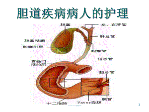 胆道疾病病人护理-课件.ppt