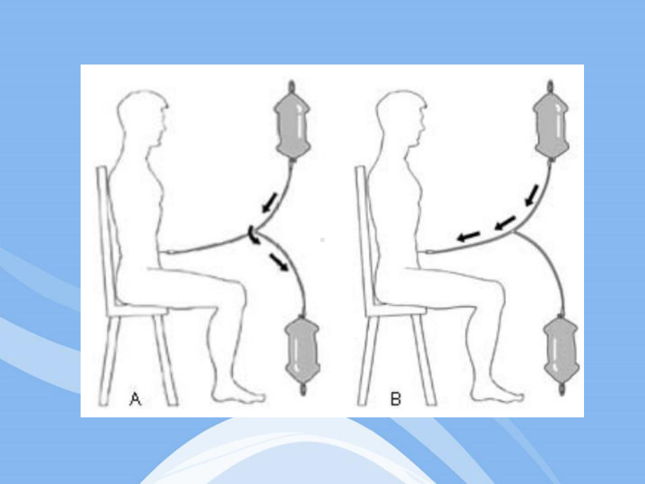 病房腹膜透析课件.ppt_第2页