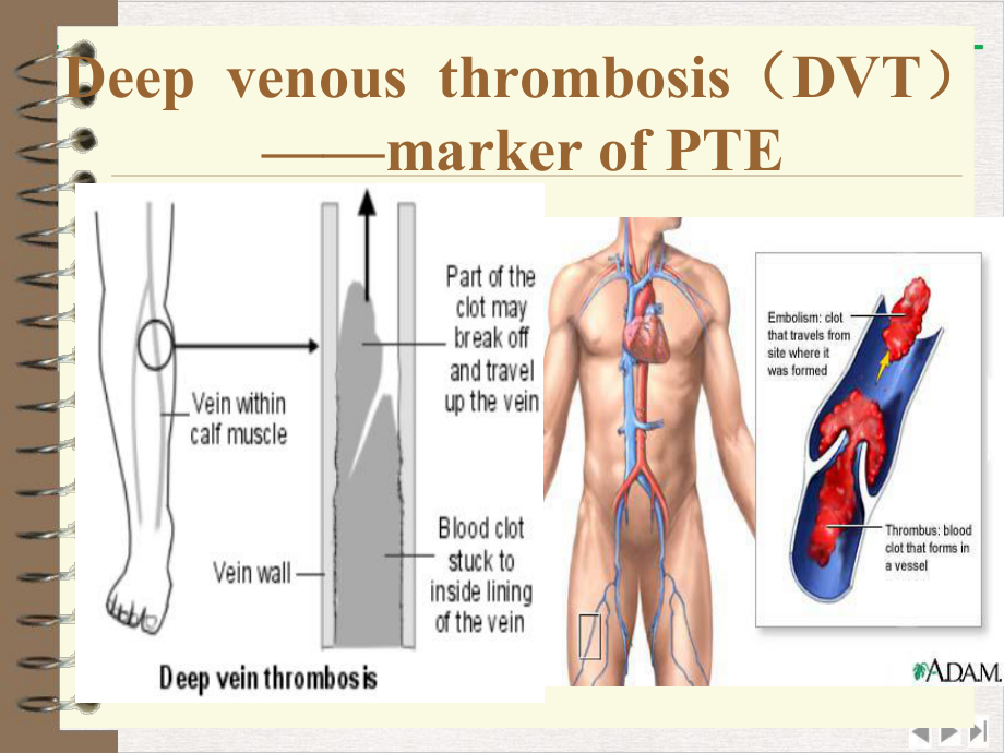 静脉血栓栓塞症病理生理的前沿问题课件整理.pptx_第2页
