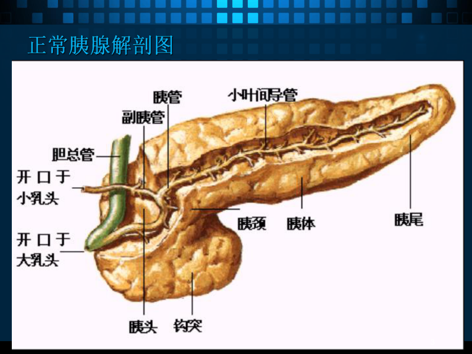 胰腺疾病的CT诊断课件整理.ppt_第3页