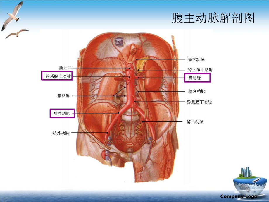 腹主动脉瘤护理查房精选课件.ppt_第2页