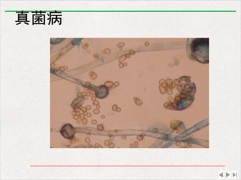 皮肤病实验室检查课件.pptx_第3页