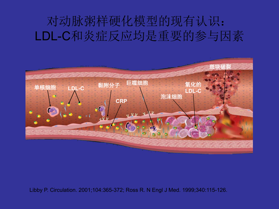 规范化调脂治疗课件.ppt_第2页